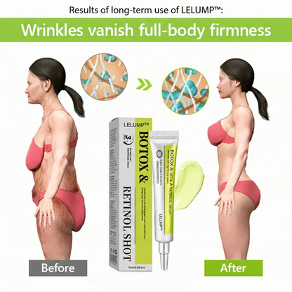 [🔥Last Day 70% OFF] LELUMP™ Botox & Retinol Shot - Eraser for Deep Wrinkles, Sagging Jowls & Puffy Eyes