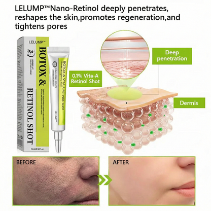 [🔥Last Day 70% OFF] LELUMP™ Botox & Retinol Shot - Eraser for Deep Wrinkles, Sagging Jowls & Puffy Eyes