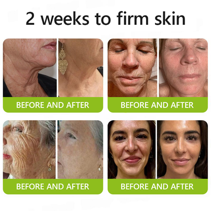 [🔥Last Day 70% OFF] LELUMP™ Botox & Retinol Shot - Eraser for Deep Wrinkles, Sagging Jowls & Puffy Eyes