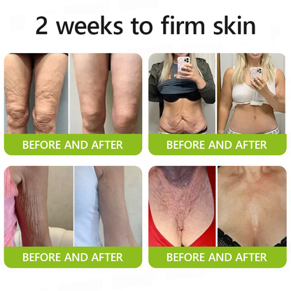 [🔥Last Day 70% OFF] LELUMP™ Botox & Retinol Shot - Eraser for Deep Wrinkles, Sagging Jowls & Puffy Eyes