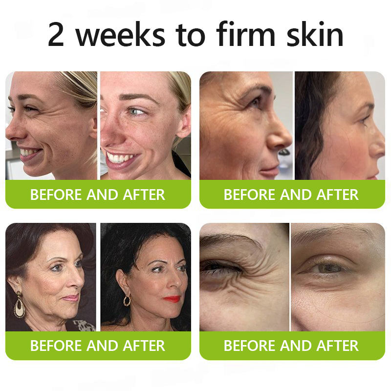 [🔥Last Day 70% OFF] LELUMP™ Botox & Retinol Shot - Eraser for Deep Wrinkles, Sagging Jowls & Puffy Eyes
