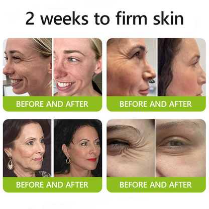 [🔥Last Day 70% OFF] LELUMP™ Botox & Retinol Shot - Eraser for Deep Wrinkles, Sagging Jowls & Puffy Eyes