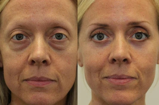 LELUMP™ Eye Mask with Bio-Collagen, Peptide Complex & Vitamin C