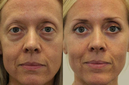 LELUMP™ Eye Mask with Bio-Collagen, Peptide Complex & Vitamin C