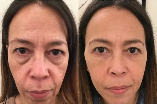 LELUMP™ Eye Mask with Bio-Collagen, Peptide Complex & Vitamin C